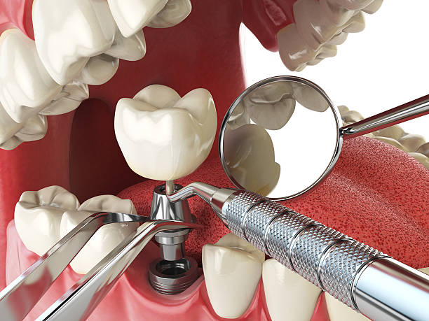 Best Emergency Dental Care for Trauma or Injury in Air Force Academy, CO
